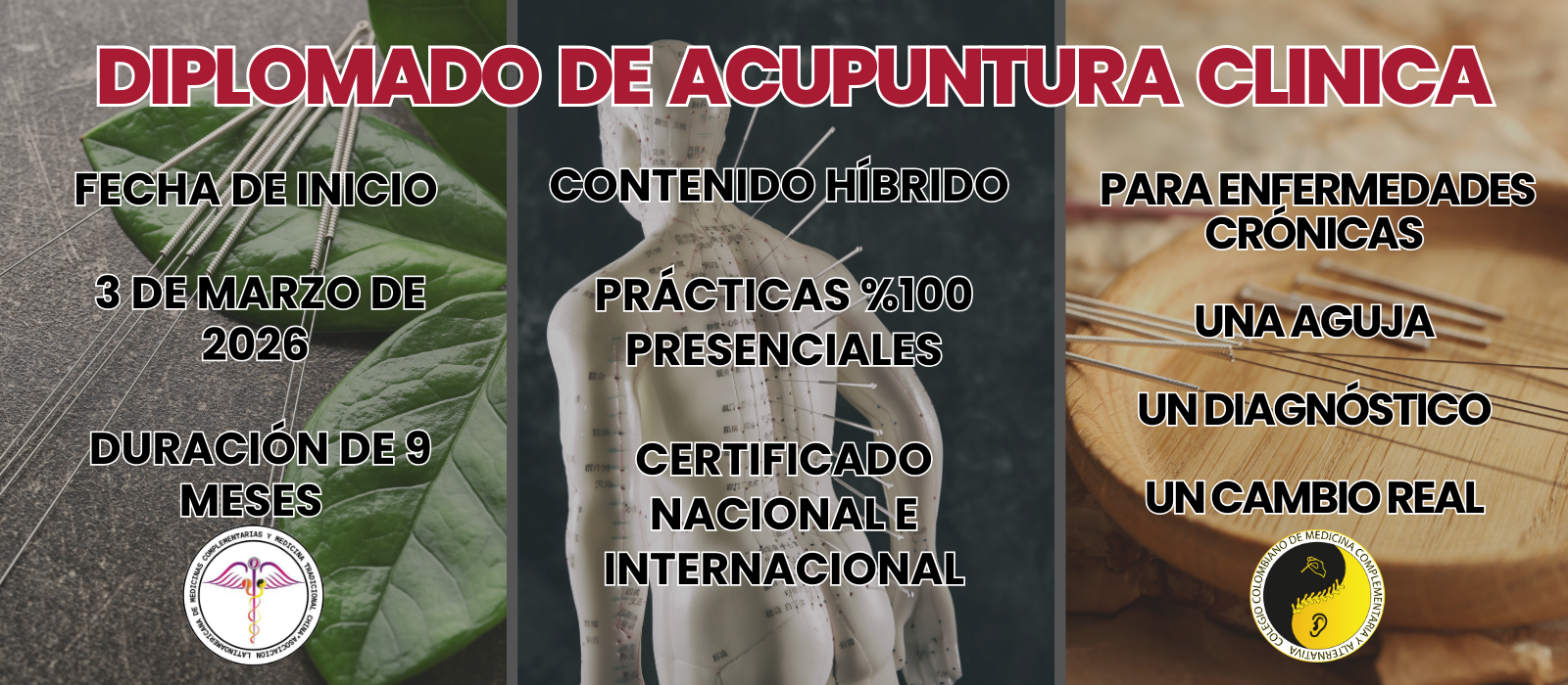 ACUPUNTURA CLINICA
